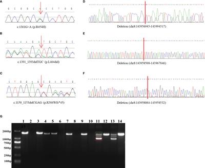 Detection of Small CYP11B1 Deletions and One Founder Chimeric CYP11B2/CYP11B1 Gene in 11β-Hydroxylase Deficiency